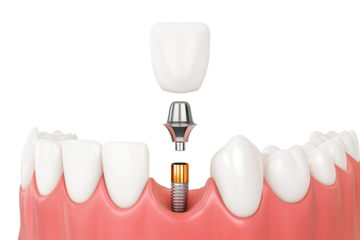 Treatment Consultation